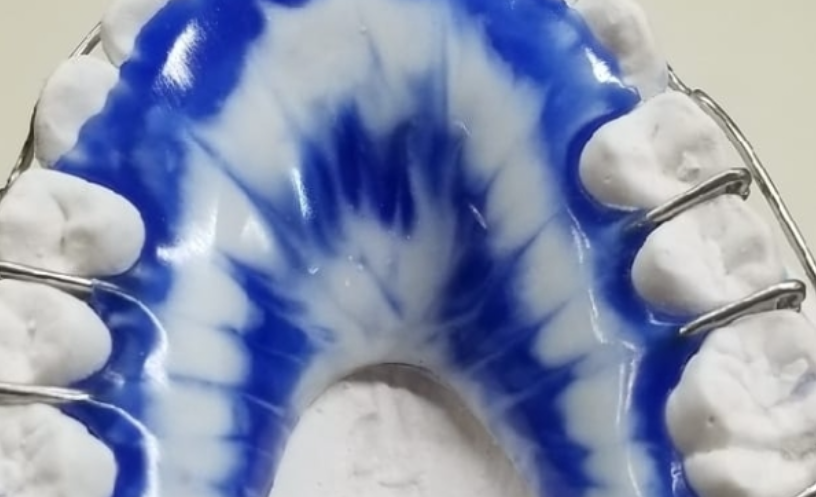 Colored Retainers
