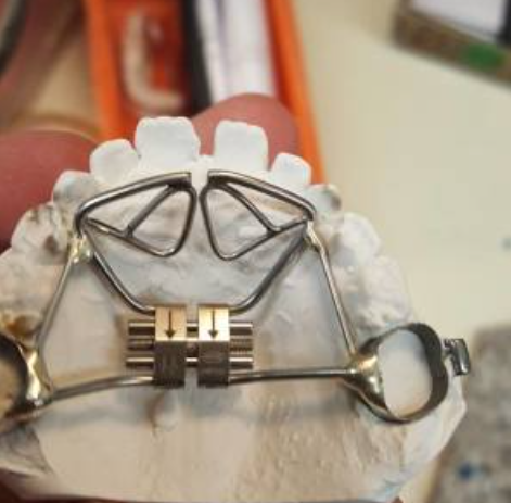 Expanders